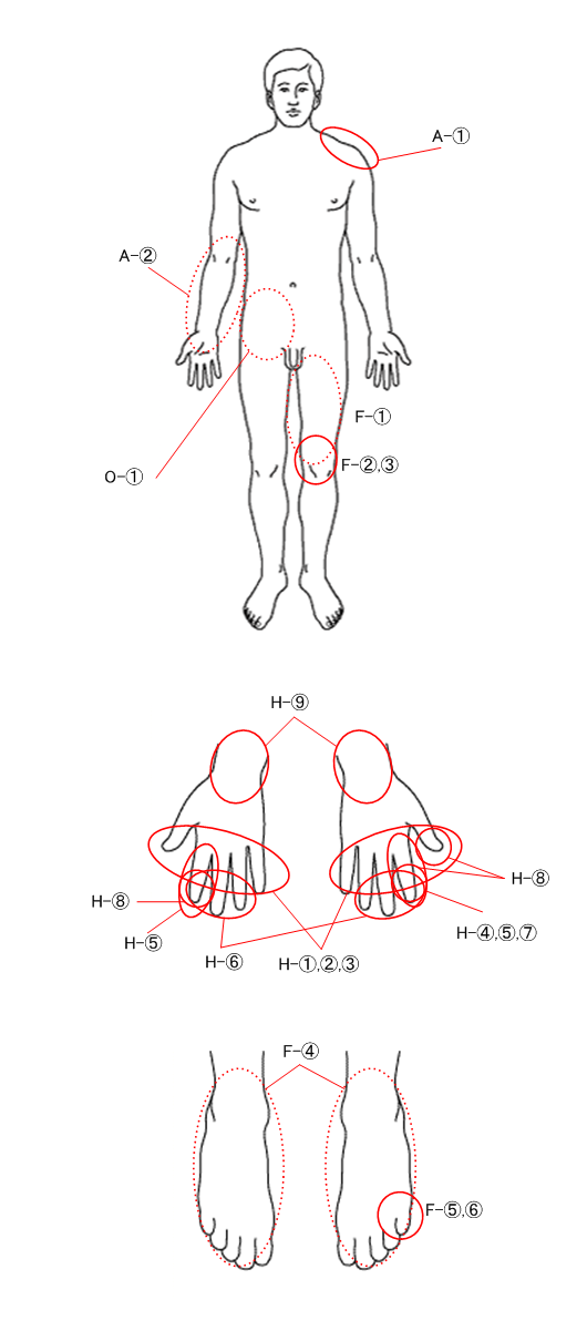 症状