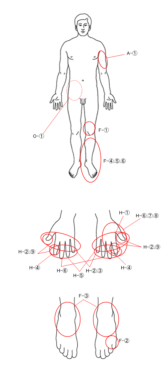 症状