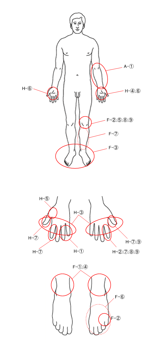 症状