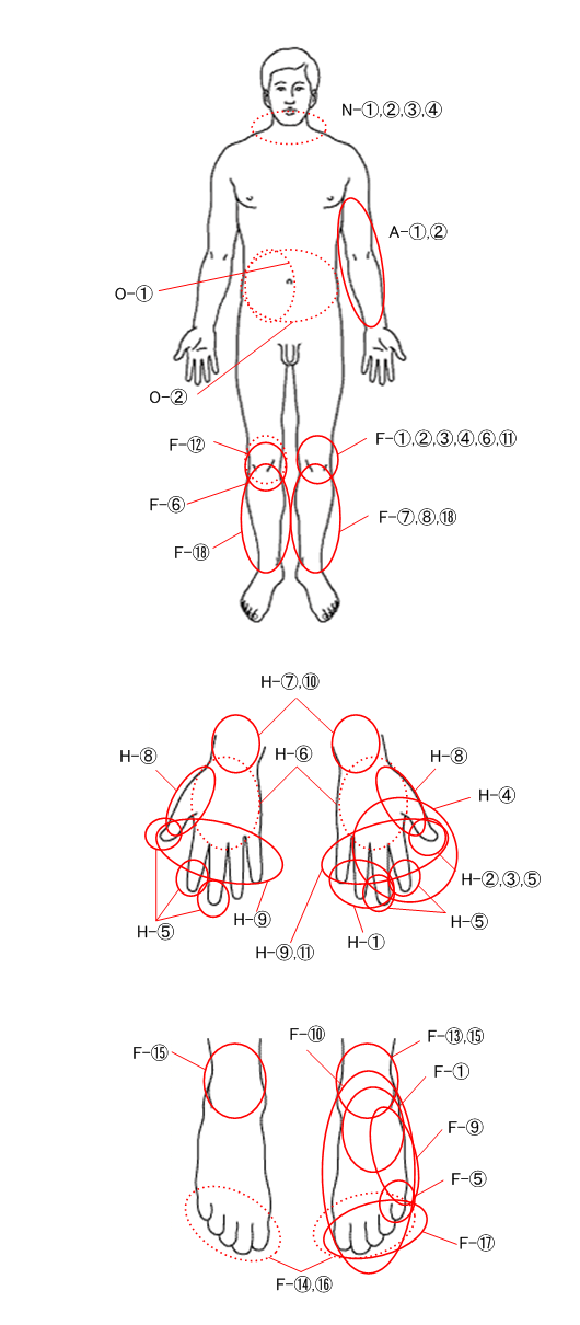 症状