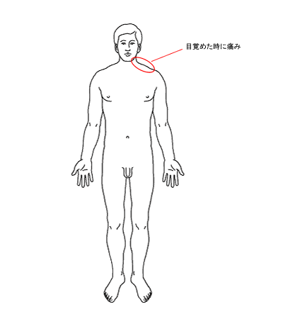 初期症状1