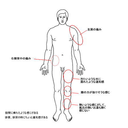 倉敷中央病院2度目の受診時の症状1