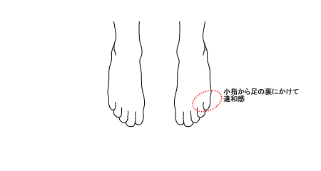 倉敷中央病院2度目の受診時の症状3